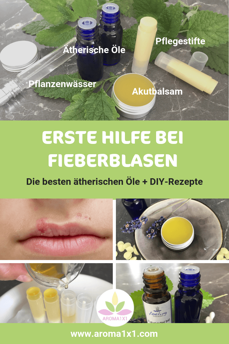 ätherische Öle gegen Fieberblasen